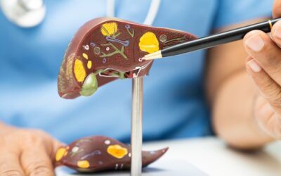 Liver Disease Manifestations: Signs, Causes, and Prevention