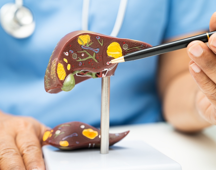 Liver Disease Manifestations: Signs, Causes, and Prevention